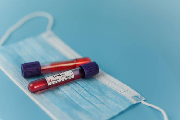istock Positive blood test result for the new rapidly spreading Coronavirus 1213936152