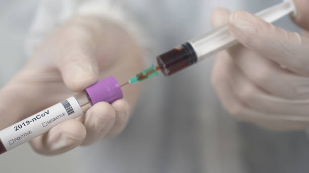 istock Coronavirus test tubes, flasks in laboratory with scientist background. 1213939655