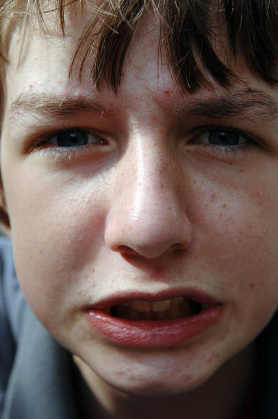 istock Angry Teenager 121394625
