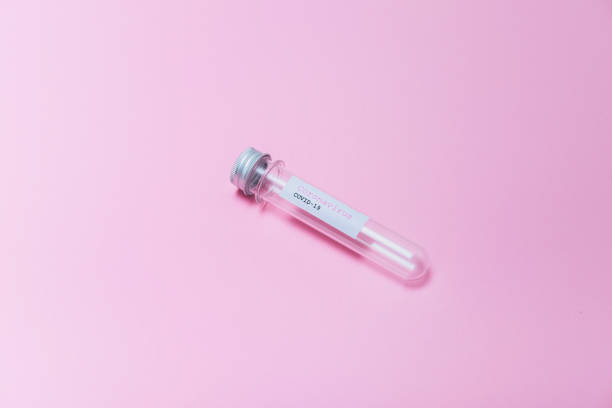 istock Pandemic minimal creative concept. COVID-19 test and empty laboratory sample for diagnosis new Coronavirus infection on pink background. 1214005016