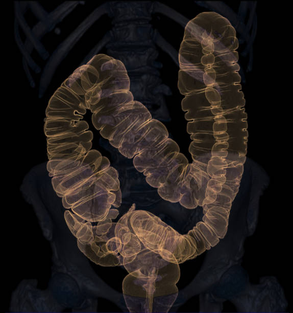 ct 콜로니그래피 3d 렌더링 이미지 - descending colon 뉴스 사진 이미지