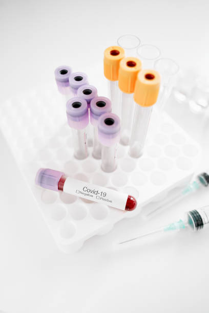 istock Coronavirus Covid 19 blood test in sample tube 1214026484