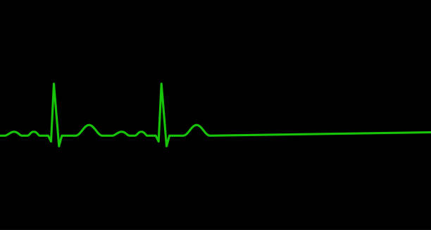 ilustrações, clipart, desenhos animados e ícones de linha de ekg. o coração pára de bater. morte. - pulse trace taking pulse computer monitor healthcare and medicine
