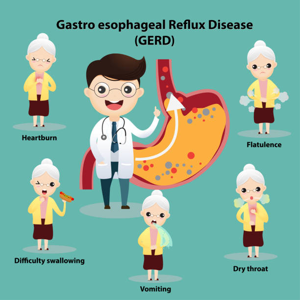 Gastro-Esophageal Reflux Disease (GERD) Senior suffering from stomach painful or Acid Reflux or Heartburn, Gas, Bloating, Belching and flatulence. Caused by gastrointestinal viral infections. gastrointestinal system disease. vector, illustration woman strangles man stock illustrations