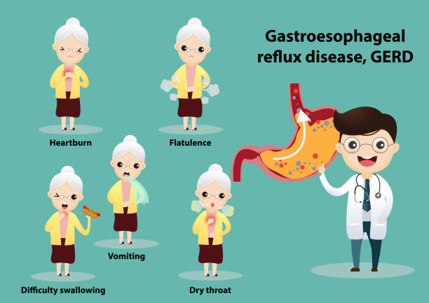 Gastro-Esophageal Reflux Disease (GERD) Senior suffering from stomach painful or Acid Reflux or Heartburn, Gas, Bloating, Belching and flatulence. Caused by gastrointestinal viral infections. gastrointestinal system disease. vector, illustration woman strangles man stock illustrations