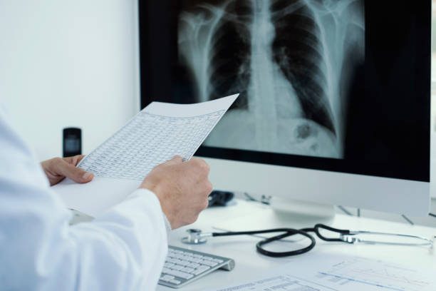 istock doctor man ckecking a chest radiograph 1214226114