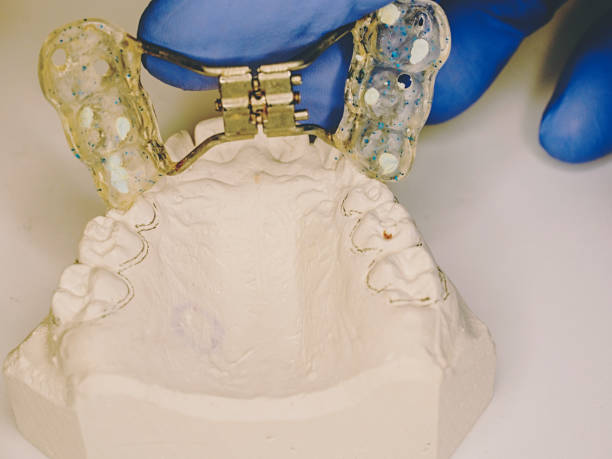 istock Retainer adjustable steel  braces on gypsum copy 1214252005