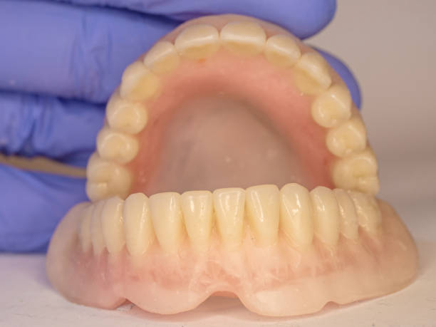 istock Acrylic dental prosthesis with metal retaining base. 1214252708