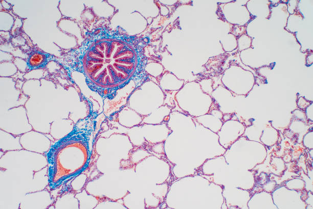 Human lung tissue under microscope, The lungs is organs of the respiratory system in humans. Human pathology education.