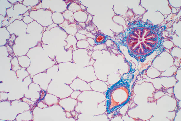 istock Human lung tissue under microscope, The lungs is organs of the respiratory system in humans. Human pathology education. 1214253206