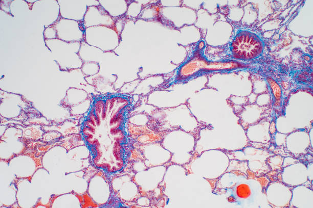 istock Human lung tissue under microscope, The lungs is organs of the respiratory system in humans. Human pathology education. 1214253215