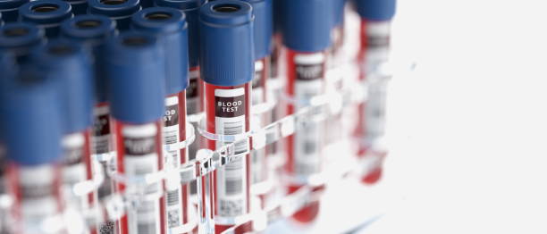пробирки крови в контейнере из плексигласа - blood blood sample blood donation tube стоковые фото и изображения