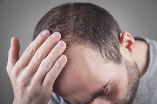 istock Caucasian man checking his hair. Hair loss problem 1214429048
