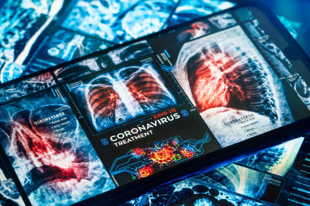 istock COVID-19 Coronavirus Treatment 1214462501