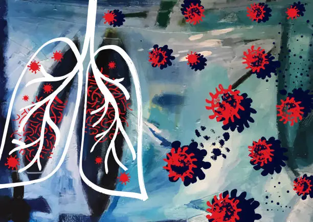 Vector illustration of Lung Virus Infection