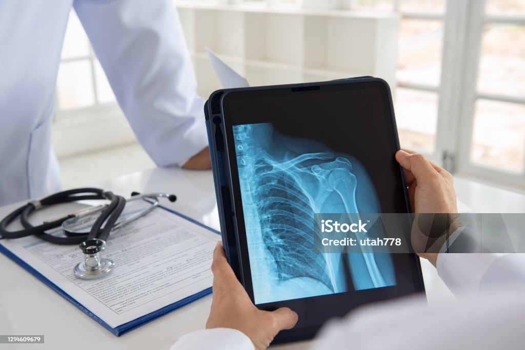 Schultergelenk Röntgenarzt - Lizenzfrei Röntgenbild Stock-Foto