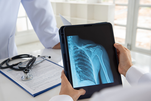 shoulder joint x-ray image on digital tablet with doctor team medical diagnose  injuries of tendons and bones.