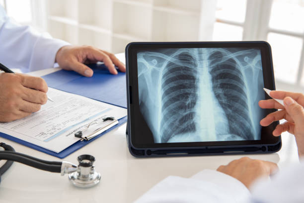 의사 팀 엑스레이 - human lung asthmatic x ray human internal organ 뉴스 사진 이미지