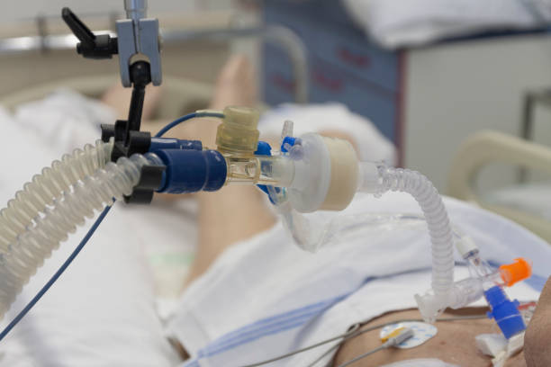 Respiratory connection tube, HME filter and suction catheter, patient connected to medical ventilator in ICU in hospital. stock photo