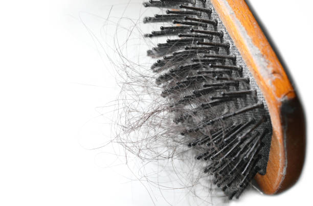 istock Hair loss images comb 1214667629