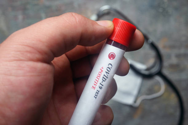 istock Testing for presence of coronavirus in Turkey. Tube containing a blood sample that has tested positive for COVID-19 1214674829