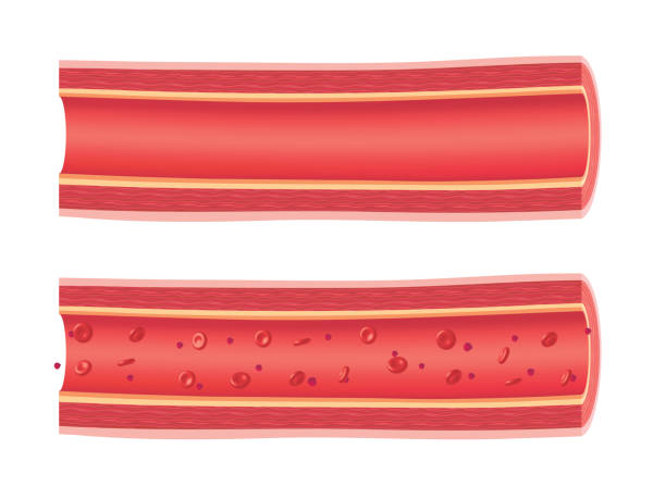 解剖学的容器 - 血管点のイラスト素材／クリップアート素材／マンガ素材／アイコン素材