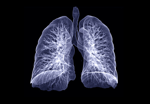 CT Chest or Lung 3D rendering image turn around on the screen for diagnosis TB,tuberculosis and covid-19 .