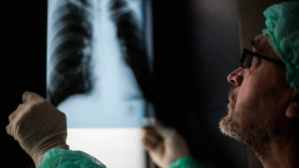 istock Roentgen shot of lungs 1214744248