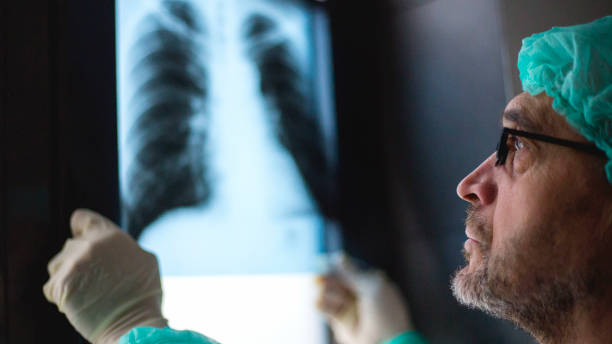 istock Roentgen shot of lungs 1214744360
