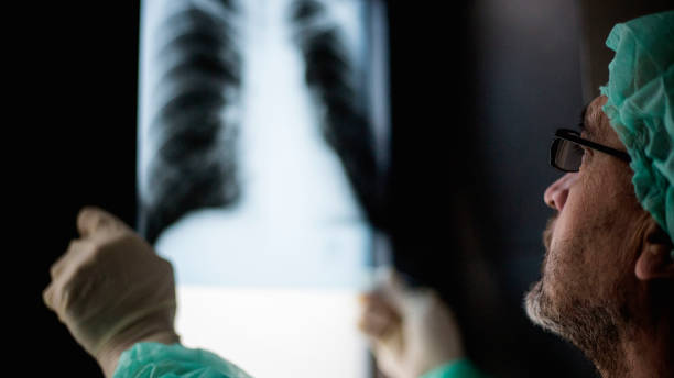 istock Roentgen shot of lungs 1214744480