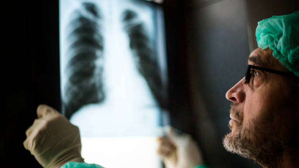 istock Roentgen shot of lungs 1214745454