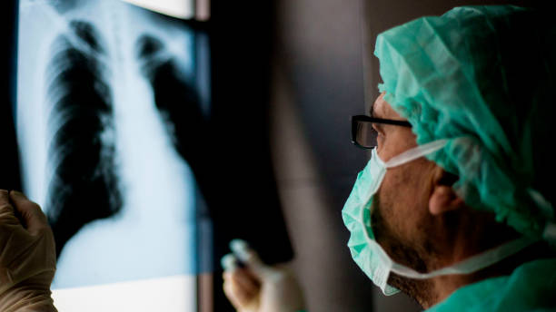 istock Roentgen shot of lungs 1214745892