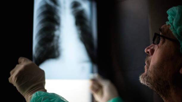 istock Roentgen shot of lungs 1214746366