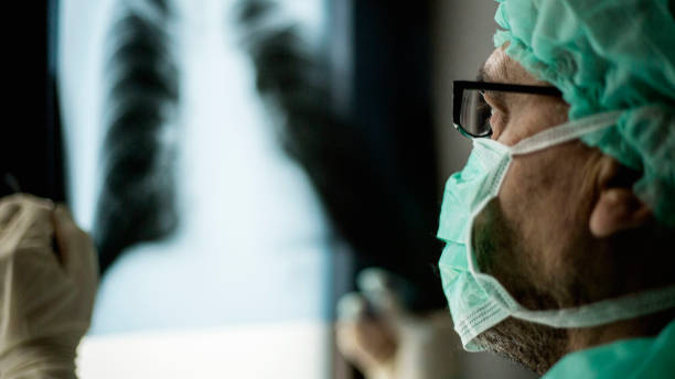 istock Roentgen shot of lungs 1214747990