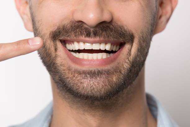 istock Close up of smiling man showing white healthy teeth 1214757183