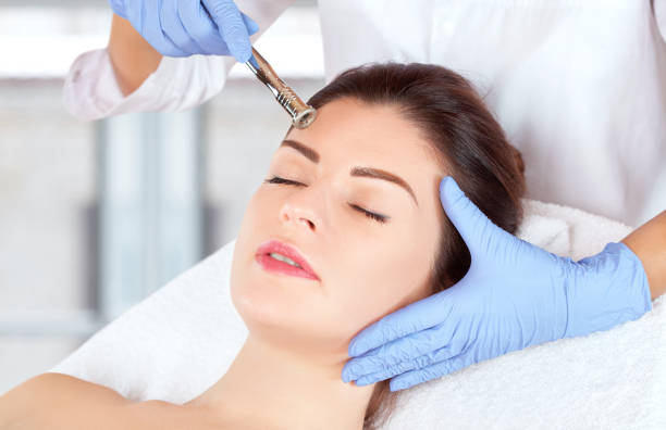 le cosmétologue fait la procédure microdermabrasion de la peau du visage d’une belle femme dans un salon de beauté. cosmétologie et soins de la peau professionnels. - human skin dry human face peeling photos et images de collection