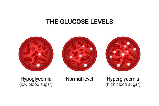 혈액에 있는 포도당 수준의 벡터 그림. - diabetes high up blood sugar test glucose stock illustrations