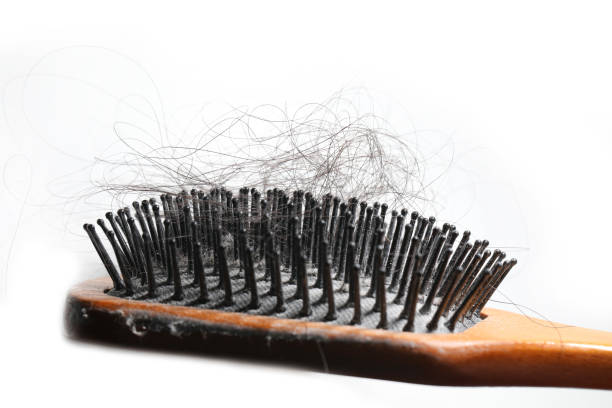 istock Dirty hair comb 1214861690