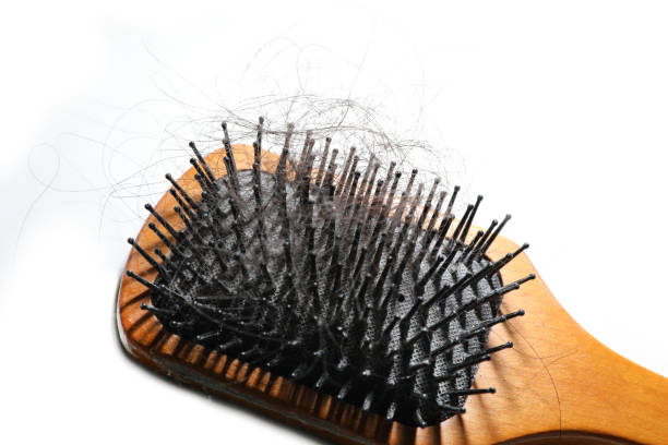 istock Dirty hair comb 1214861751