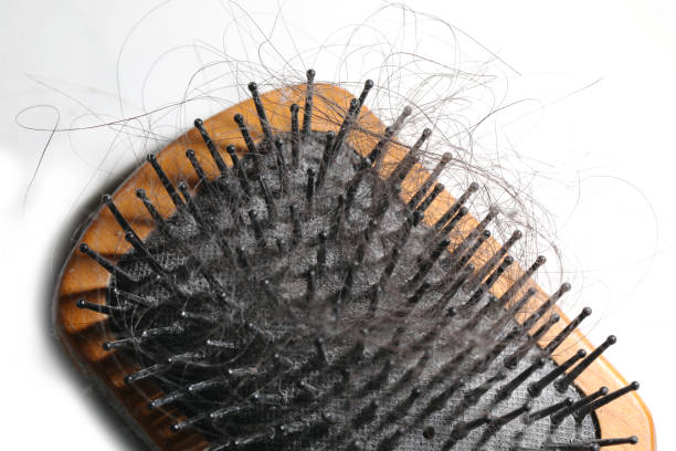 istock Dirty hair comb 1214861835