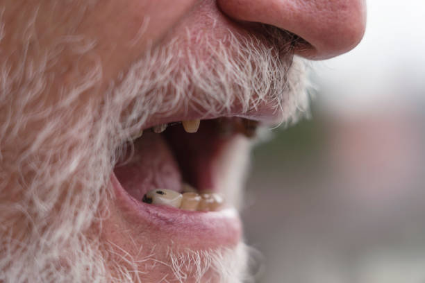 istock Male mouth with Bad teeth 1214926271