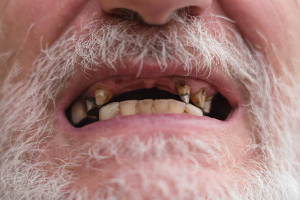 męskie usta ze złymi zębami - cynga zdjęcia i obrazy z banku zdjęć