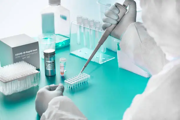 Photo of Novel coronavirus detection: pcr kit for detection of SARS-COV-2 novel coronavirus and rapid kit to detect antibodies for the virus in blood of recovered patients. Epidemiologist works in test lab.