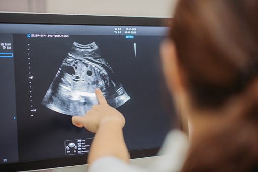 Primer plano del joven médico chino asiático que muestra una ecografía en el monitor a la mujer embarazada en la habitación del médico en el hospital photo