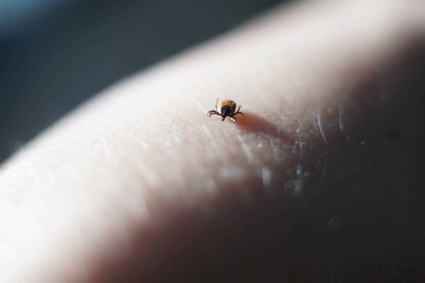 istock Female tick ( Ixodes scapularis) crawling on skin ready to bite 1214973555