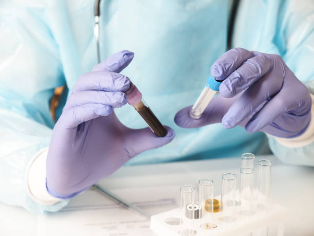 istock Blood test tube 1214974222
