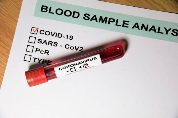 istock Coronavirus Blood test tube and result form 1215049164