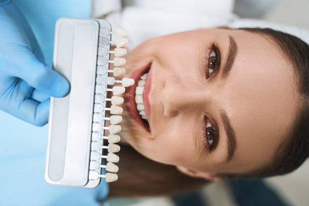 smiling woman is choosing veneers stock photo - dental drill dental equipment dental hygiene drill imagens e fotografias de stock