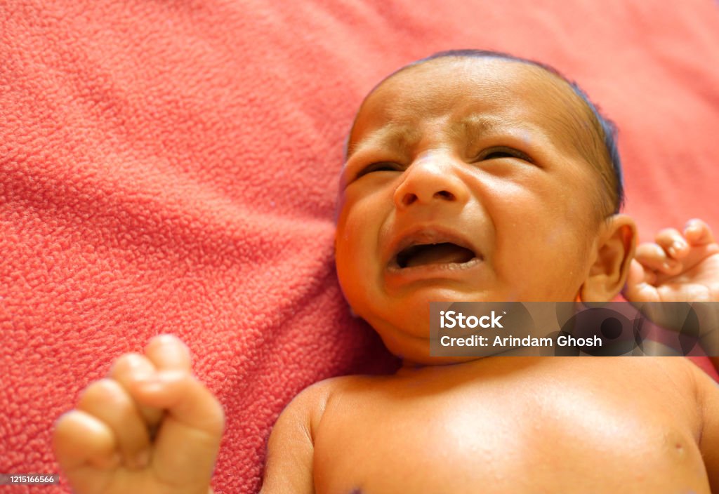Un Bebé Ictericia Neonatal De Color Piel Amarillo Llorando De Dolor Foto de  stock y más banco de imágenes de Bebé - iStock