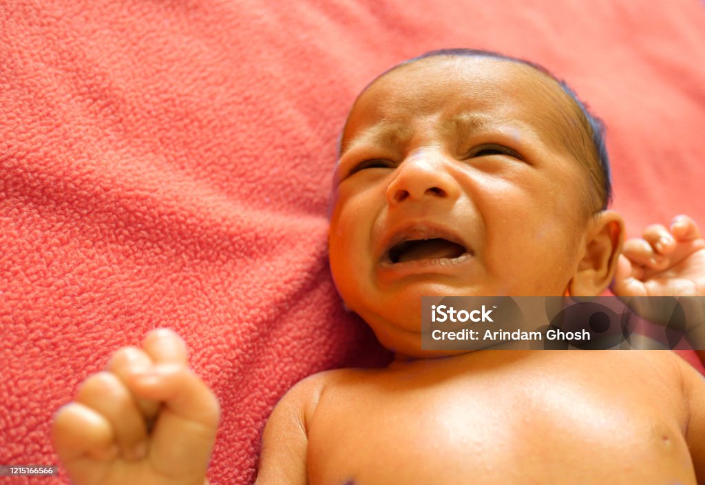 Un Bebé Ictericia Neonatal De Color Piel Amarillo Llorando De Dolor Foto de stock y más banco de imágenes de Bebé - iStock Un Bebé Ictericia Neonatal De Color Piel Amarillo Llorando De Dolor Foto de stock y más banco de imágenes de Bebé - iStock